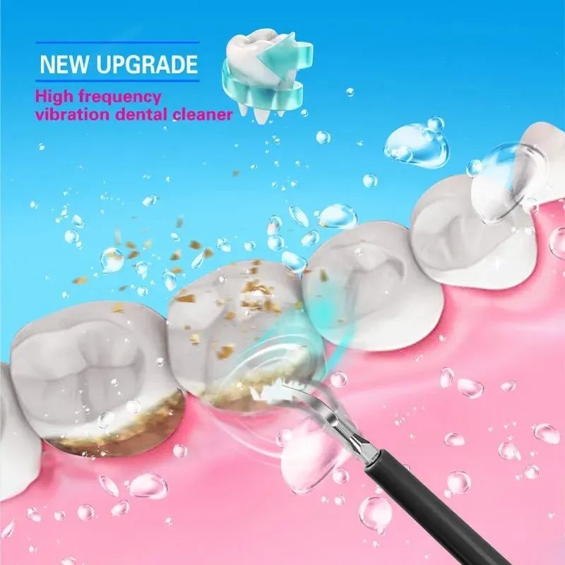 Limpiador Dental Eléctrico