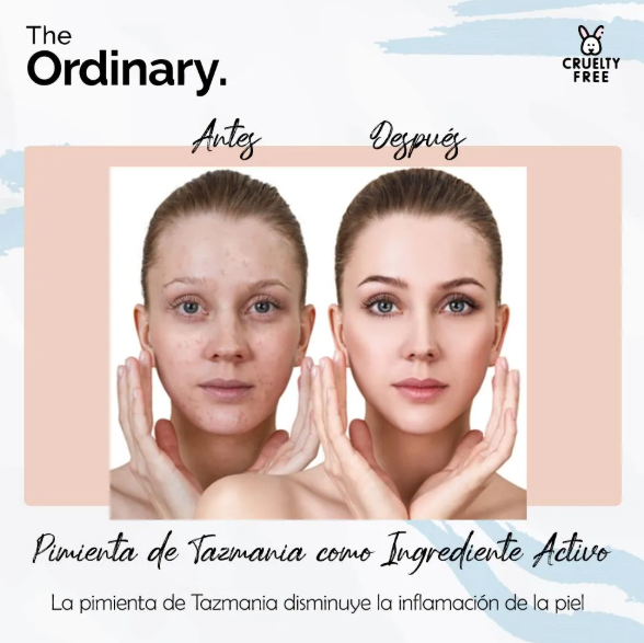 Mascarilla Exfoliante AHA 30% + BHA 2% Peeling Solution The Ordinary