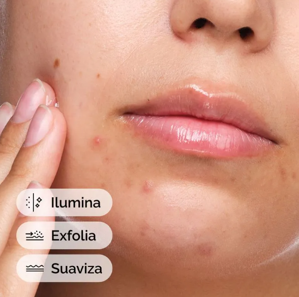 Suero de Ácido Salicílico Salicylic Acid 2% Solution The Ordinary
